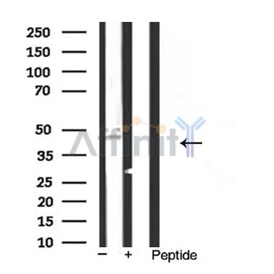 Kir6.2 Antibody – Figure 1 of 5