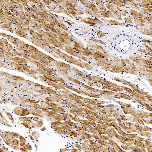 GLUT-4 Polyclonal Antibody – Figure 1 of 3