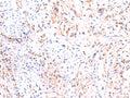 PHKG2 Polyclonal Antibody – Figure 1 of 2