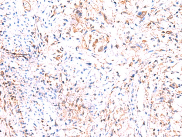 PHKG2 Polyclonal Antibody – Figure 1 of 2