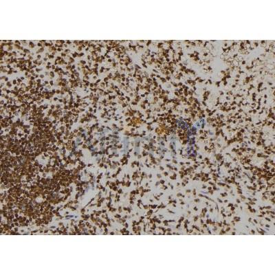 DF6189 at 1/100 staining Human spleen tissue by IHC-P. The sample was formaldehyde fixed and a heat mediated antigen retrieval step in citrate buffer was performed. The sample was then blocked and incubated with the antibody for 1.5 hours at 22°C. An HRP conjugated goat anti-rabbit antibody was used as the secondary antibody.