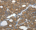 SLC12A4 Polyclonal Antibody – Figure 1 of 3