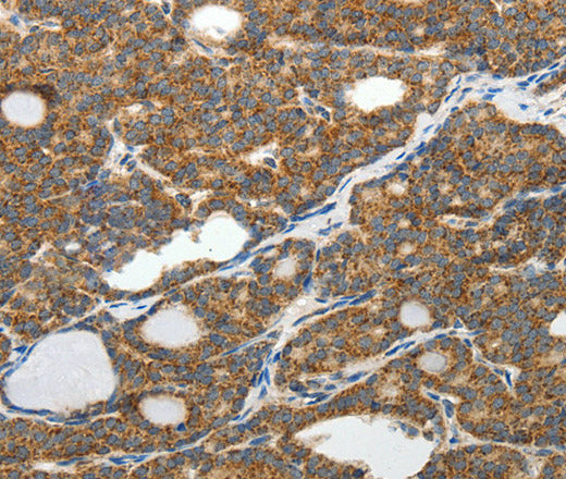 SLC12A4 Polyclonal Antibody – Figure 1 of 3