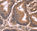CCDC106 Polyclonal Antibody – Figure 1 of 3