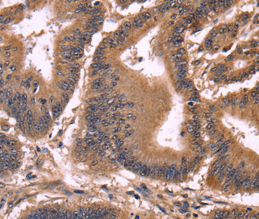 CCDC106 Polyclonal Antibody – Figure 1 of 3