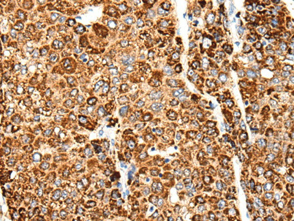 CACNG5 Polyclonal Antibody – Figure 1 of 3