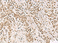 GABPB1 Polyclonal Antibody – Figure 1 of 3