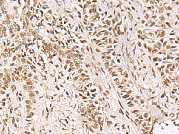 GABPB1 Polyclonal Antibody – Figure 1 of 3