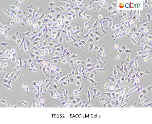 SACC-LM Cells – Figure 1 of 1