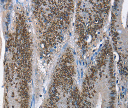 GNRH1 Polyclonal Antibody – Figure 1 of 3
