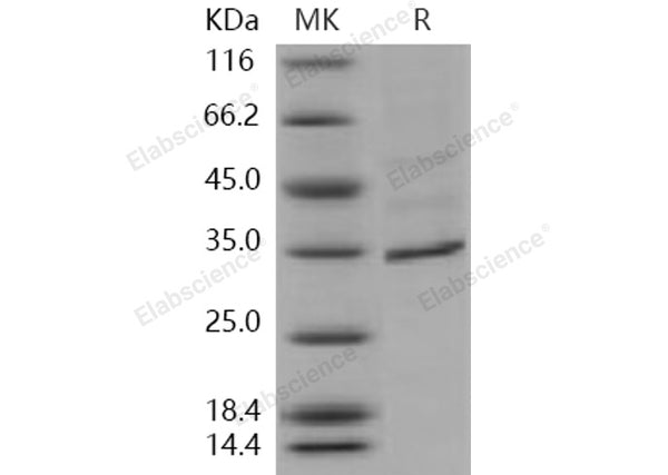 Recombinant Human FANCA/FACA Protein (His Tag) – Figure 1 of 2