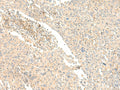 GLIS1 Polyclonal Antibody – Figure 1 of 3