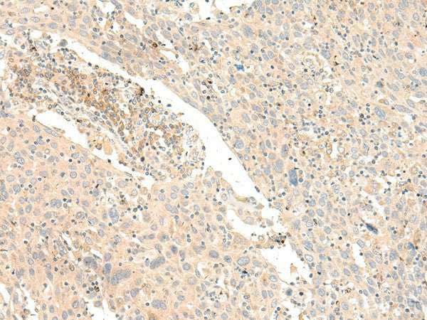 GLIS1 Polyclonal Antibody – Figure 1 of 3