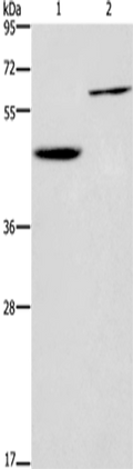 DOK1 Polyclonal Antibody – Figure 1 of 2