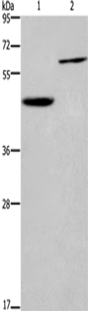 DOK1 Polyclonal Antibody – Figure 1 of 2