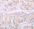 ADCY7 Polyclonal Antibody – Figure 1 of 2