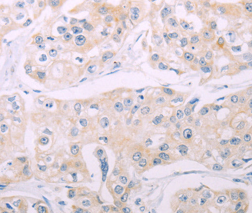 ADCY7 Polyclonal Antibody – Figure 1 of 2