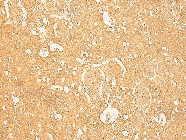 RNASE4 Polyclonal Antibody – Figure 1 of 2