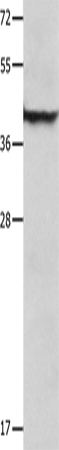 SERPINB5 Polyclonal Antibody – Figure 1 of 4