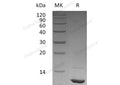 Recombinant Human IGF-1/IGF1 Protein – Figure 1 of 3