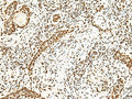 ILF3 Polyclonal Antibody – Figure 1 of 3