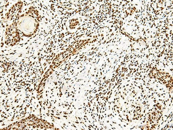 ILF3 Polyclonal Antibody – Figure 1 of 3