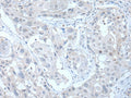 ANGPTL6 Polyclonal Antibody – Figure 1 of 3