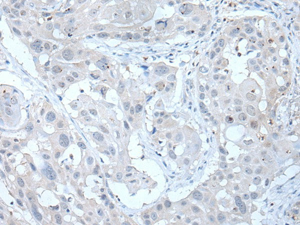ANGPTL6 Polyclonal Antibody – Figure 1 of 3