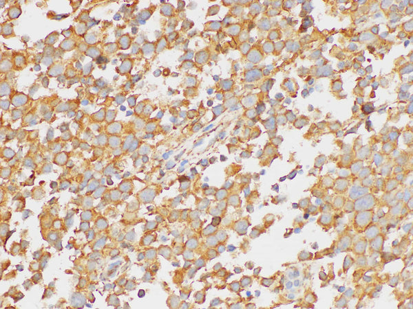 PAIP1 Polyclonal Antibody – Figure 1 of 5