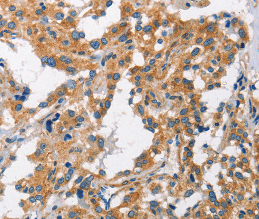 CHMP1A Polyclonal Antibody – Figure 1 of 3