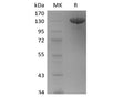 Recombinant Human Tie-2 (C-Fc) – Figure 1 of 2