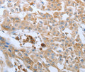 FGF1 Polyclonal Antibody – Figure 1 of 3