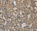 DCTN3 Polyclonal Antibody – Figure 1 of 3