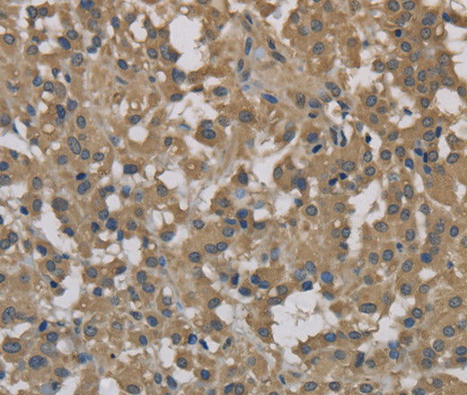 DCTN3 Polyclonal Antibody – Figure 1 of 3