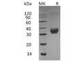 Recombinant Human Fas/CD95/TNFRSF6 Protein (His Tag) – Figure 1 of 2