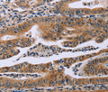 FAF1 Polyclonal Antibody – Figure 1 of 3