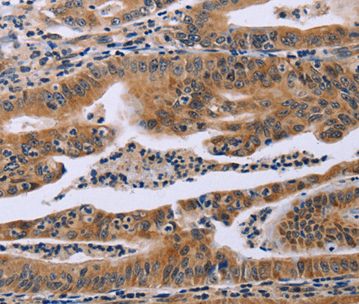 FAF1 Polyclonal Antibody – Figure 1 of 3