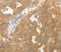MAP1B Polyclonal Antibody – Figure 1 of 3