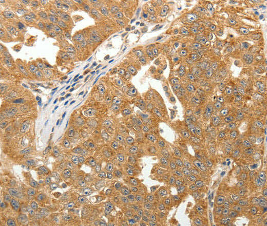MAP1B Polyclonal Antibody – Figure 1 of 3