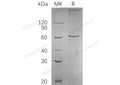 Recombinant Human SMAD4 Protein (His Tag) – Figure 1 of 2