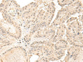 ZGPAT Polyclonal Antibody – Figure 1 of 2