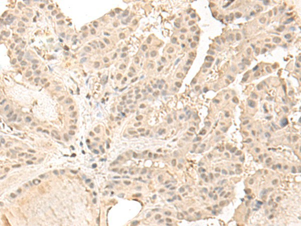 ZGPAT Polyclonal Antibody – Figure 1 of 2