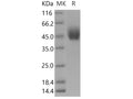 Recombinant Human DPEP2 Protein (Fc Tag) – Figure 1 of 2