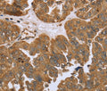 IKBKE Polyclonal Antibody – Figure 1 of 3