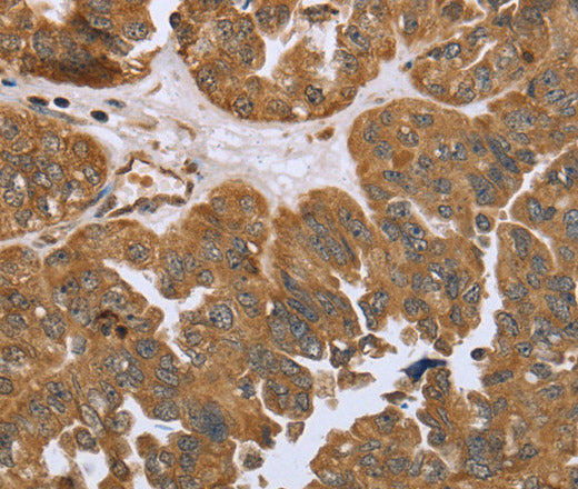 IKBKE Polyclonal Antibody – Figure 1 of 3