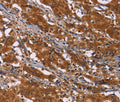 DCBLD2 Polyclonal Antibody – Figure 1 of 3