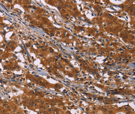 DCBLD2 Polyclonal Antibody – Figure 1 of 3