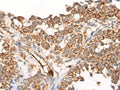 CA5B Polyclonal Antibody – Figure 1 of 2
