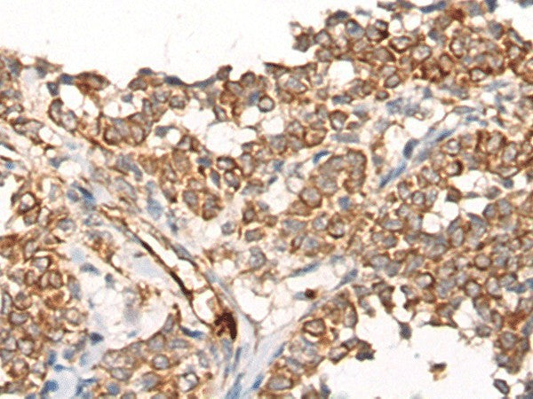 CA5B Polyclonal Antibody – Figure 1 of 2