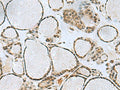PTPA Polyclonal Antibody – Figure 1 of 2
